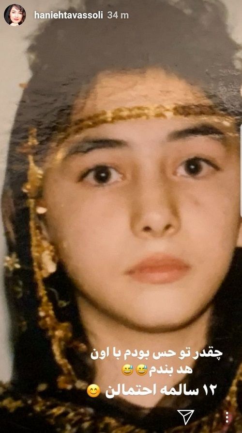 هانیه توسلی در دوران کودکی - عمل زیبایی هانیه توسلی