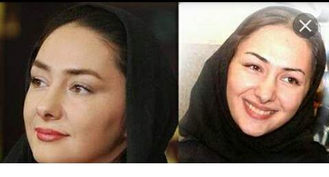 هانیه توسلی قبل از عمل زیبایی