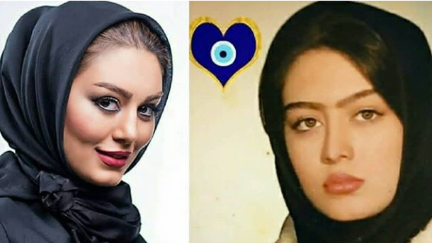 سحر قریشی قبل و بعد از عمل زیبایی