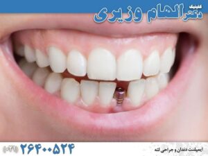 مطب دندانپزشکی و خدمات زیبایی دندان