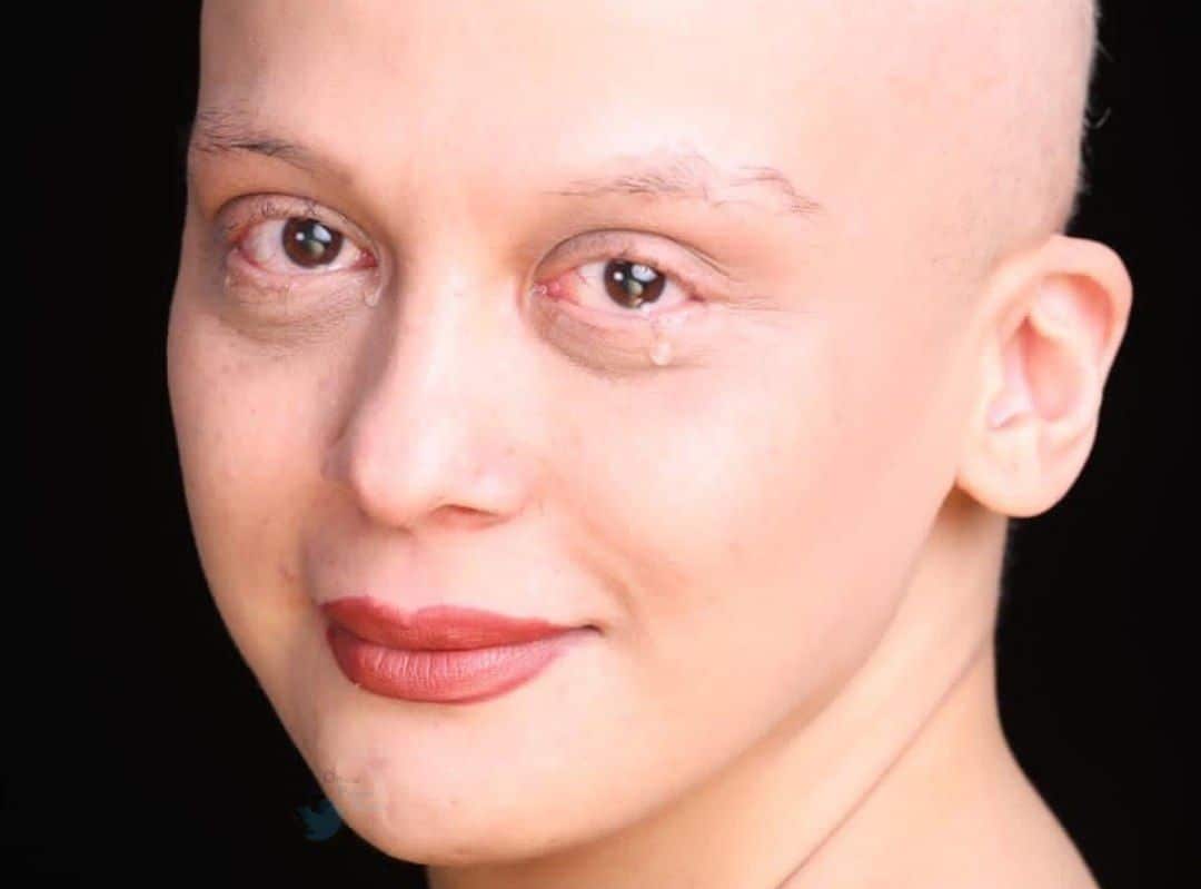 سرطان با مارال فرجاد چه کرده ؟